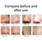 Multi-functional Blackhead Remover Pore Acne Pimple Removal Face  Nose Cleaner Vacuum Suction Facial