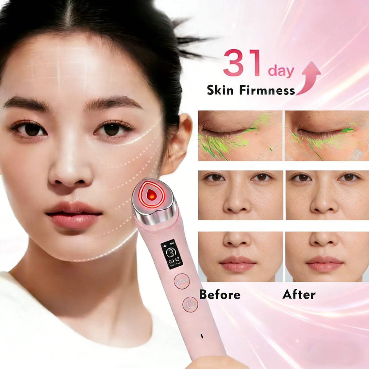 6-in-1 RF Facial Beauty Device | Anti-Aging Skin Tightening & Pore Refining Massager