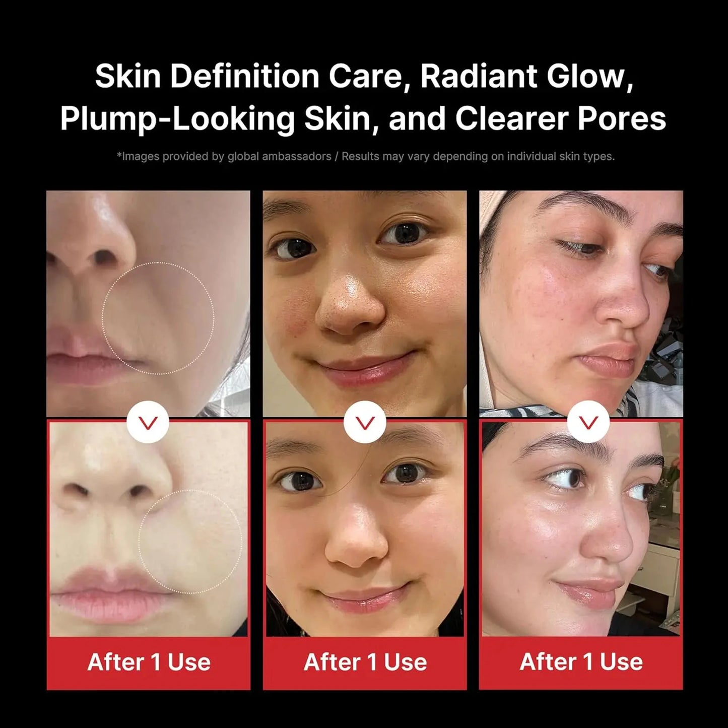 6-in-1 RF Facial Beauty Device | Anti-Aging Skin Tightening & Pore Refining Massager